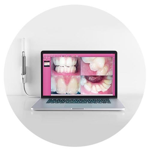 Caméra C-U2 HD Myray